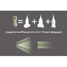 Handheld Scanner Probe Price Doppler Wireless Ultrasound